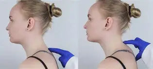 Schéma montrant une cyphose cervicale ou bosse de bison causée par une mauvaise posture de la tête.